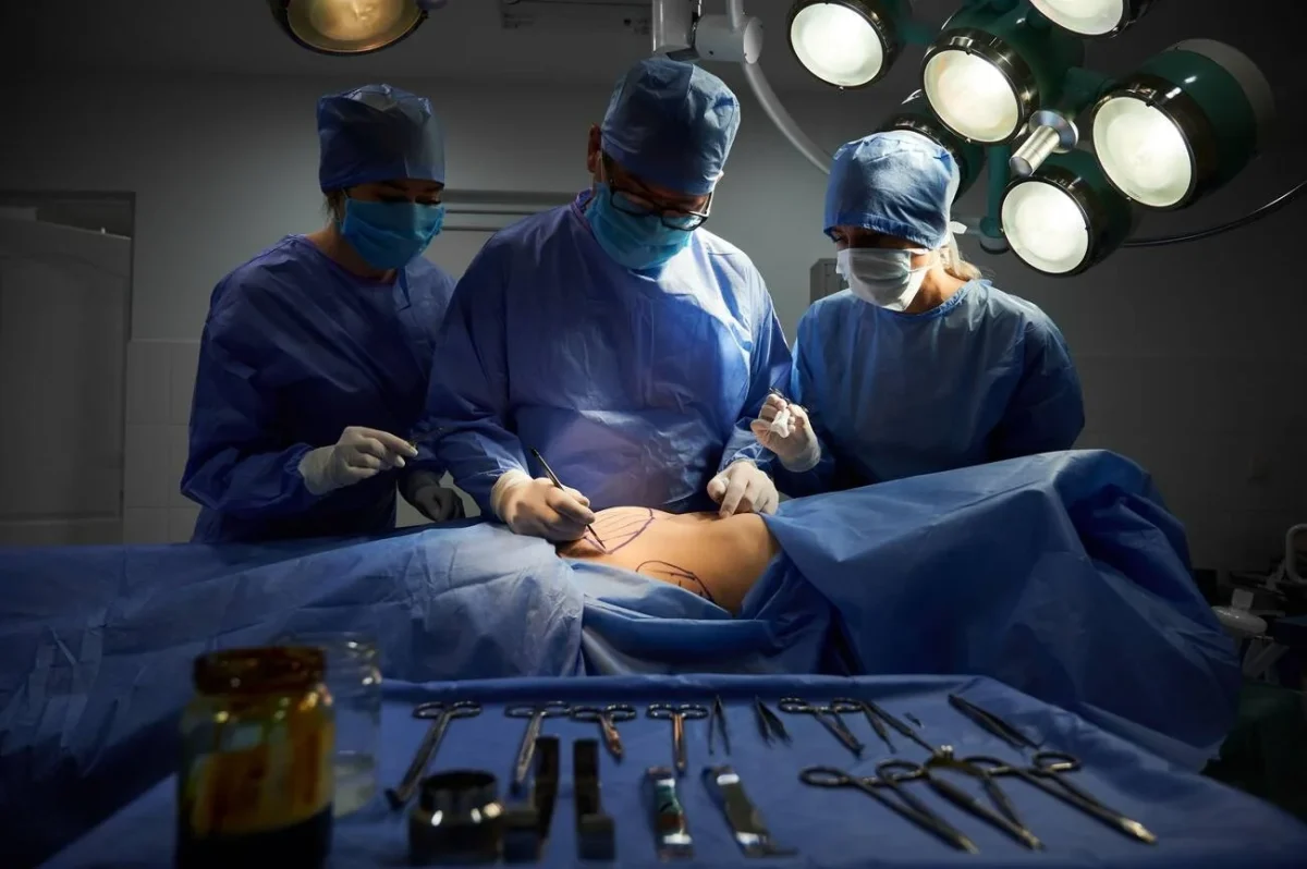 cosmetic surgery in iran