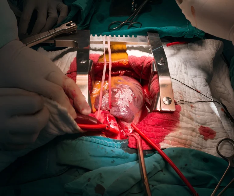 Cardiology in iran cost