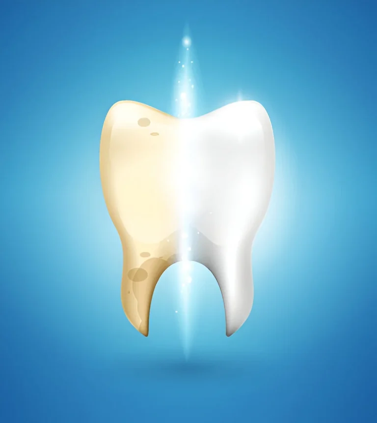 Dental Implant Cost in Iran: