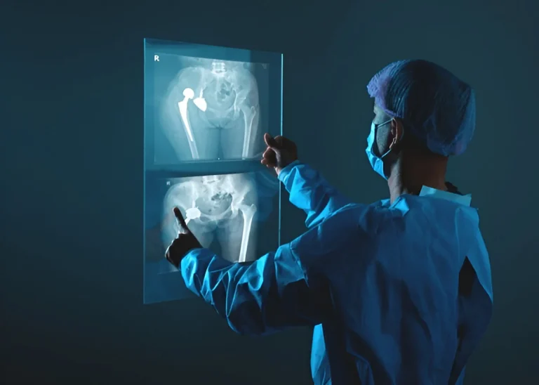 hip replacment in iran