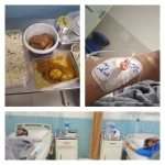"Kidney transplant patient receiving aftercare at Shariati Hospital in Tehran, supported by Fardad Medical Tourism"